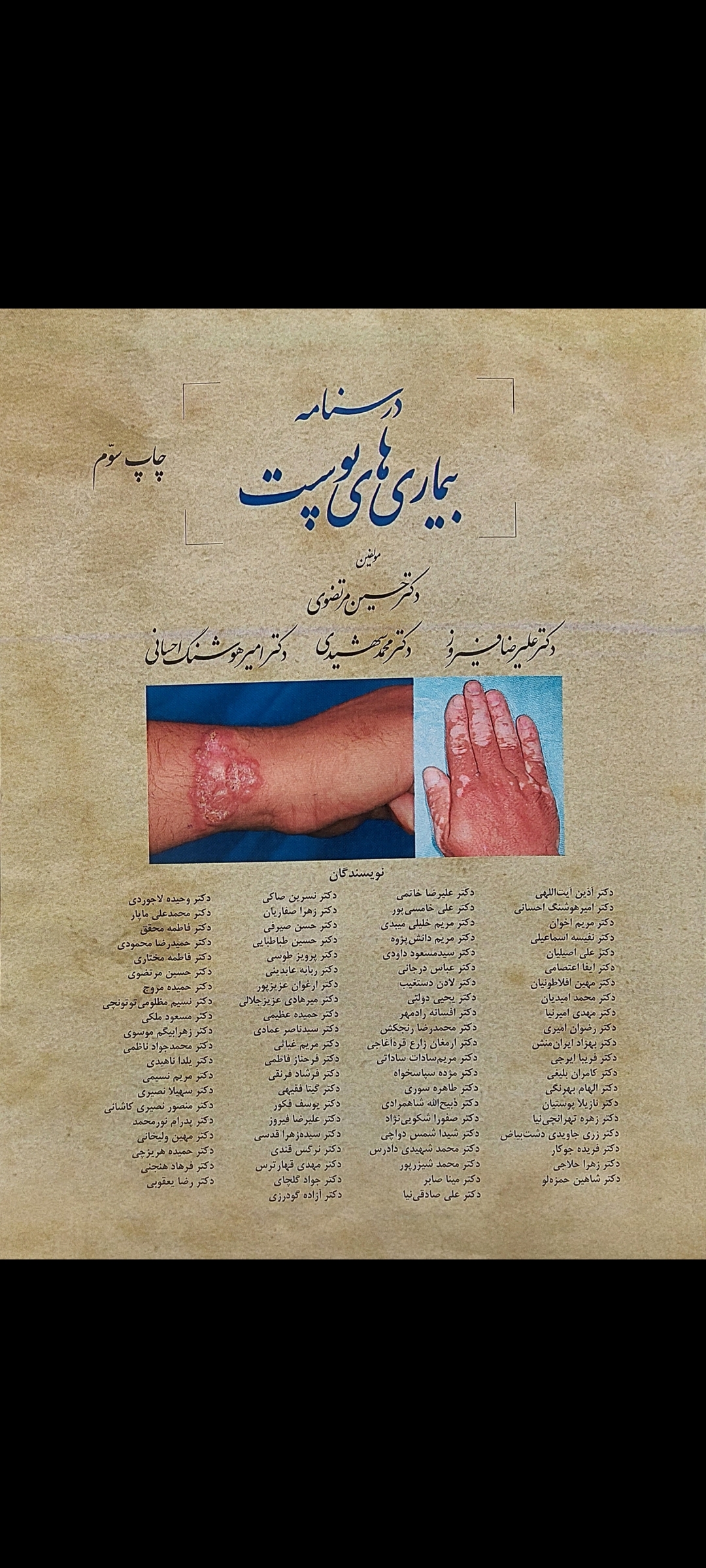 پایانه - درسنامه بیماری های پوست