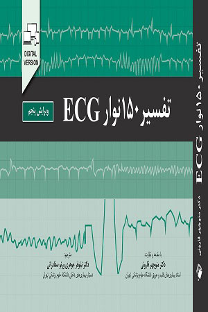 پایانه - تفسیر 150 نوار ECG