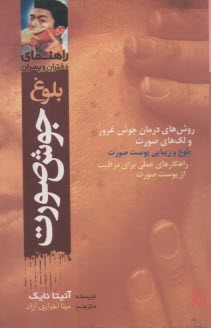 پایانه - بلوغ، جوش صورت