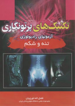 پایانه - تکنیکهای پرتونگاری تنه و شکم