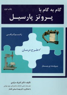 پایانه - گام به گام پروتز پارسیل