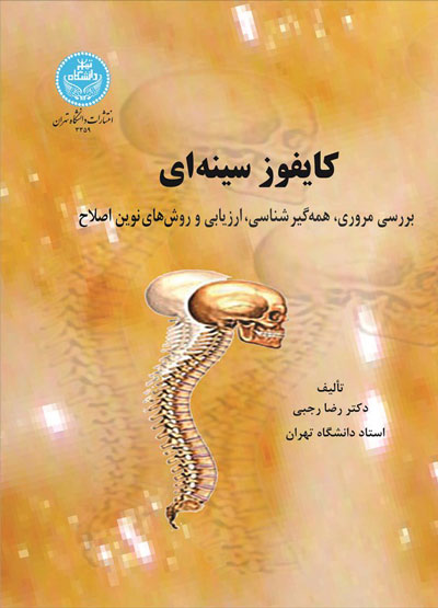 پایانه - کایفوز سینه  ای