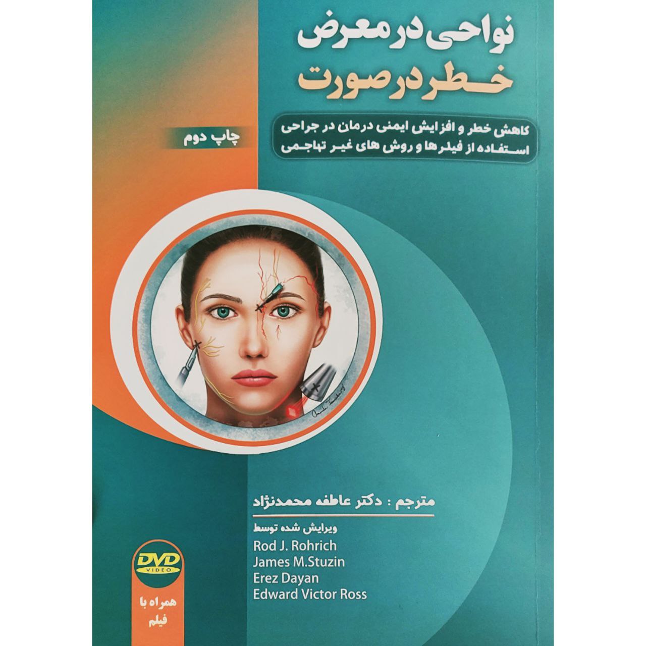 پایانه - نواحی در معرض خطر در صورت