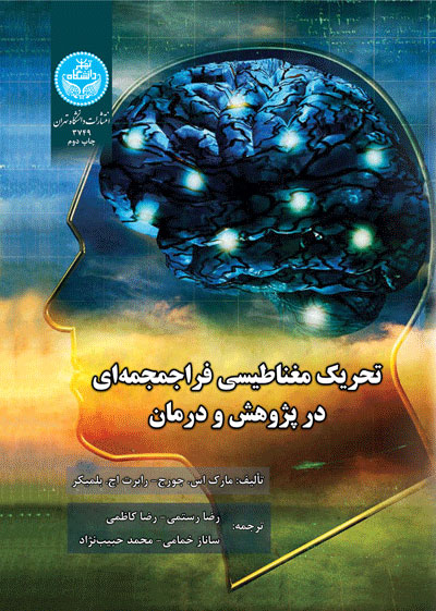 پایانه - تحریک مغناطیسی فراجمجمه ای