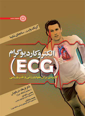 پایانه - الکتروکاردیوگرام (ECG)