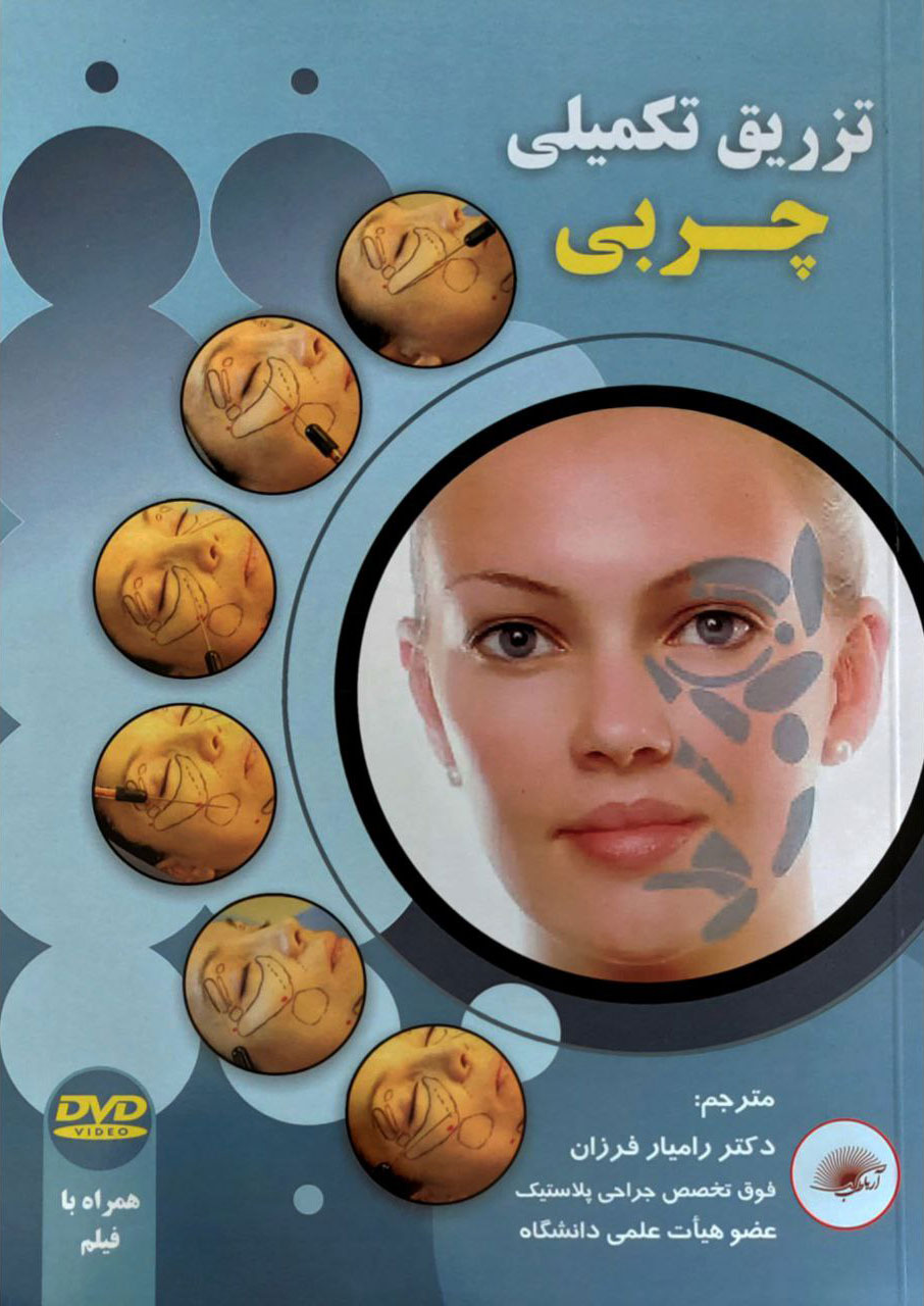 پایانه - تزریق تکمیلی چربی