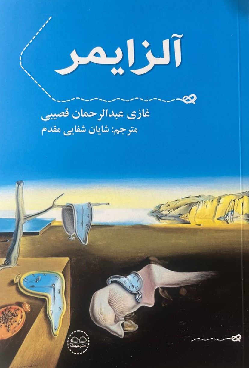 پایانه - آلزایمر