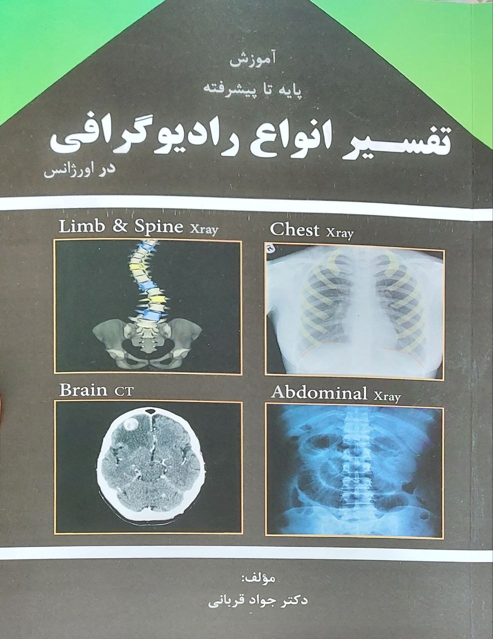 پایانه - تفسیر انواع رادیوگرافی در اورژانس