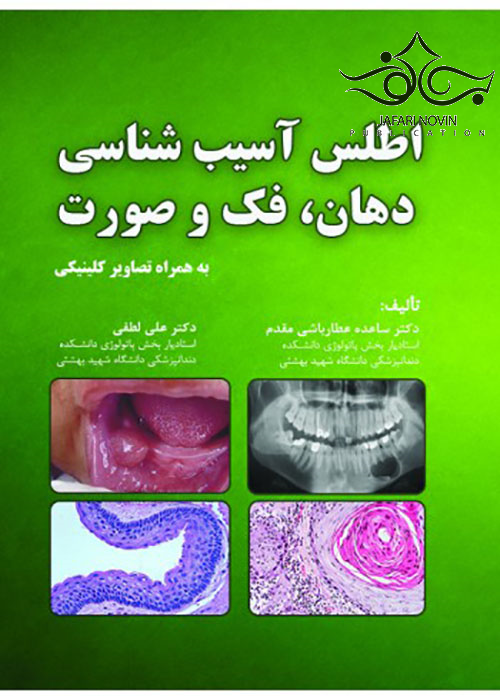 پایانه - اطلس آسیب شناسی دهان فک و صورت