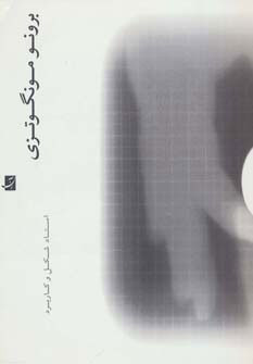 پایانه - برونو مونگوتزی