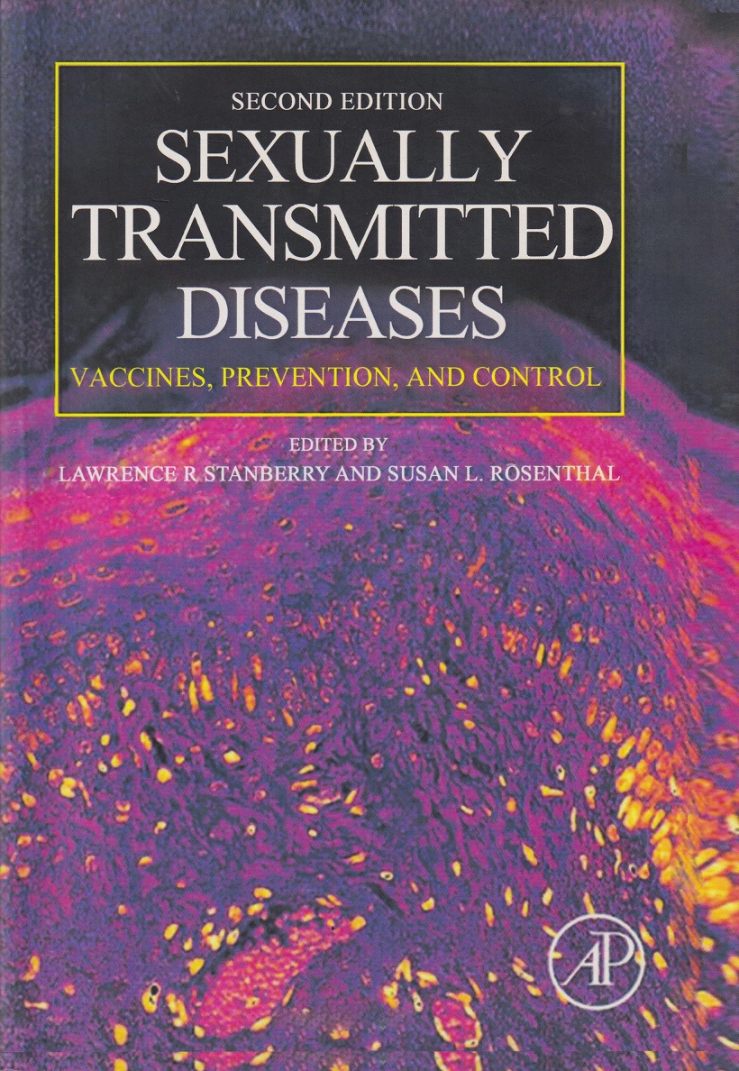 پایانه - Sexually Transmitted Diseases