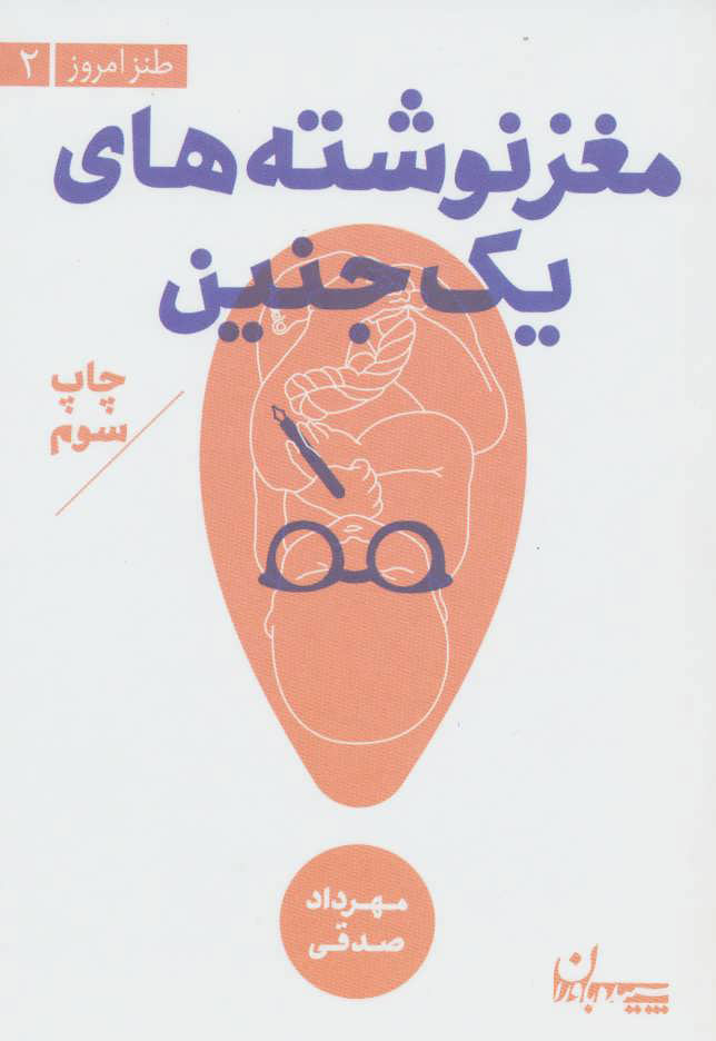 پایانه - مغز نوشته های یک جنین