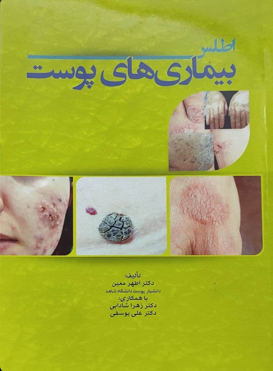 پایانه - اطلس بیماری های پوست