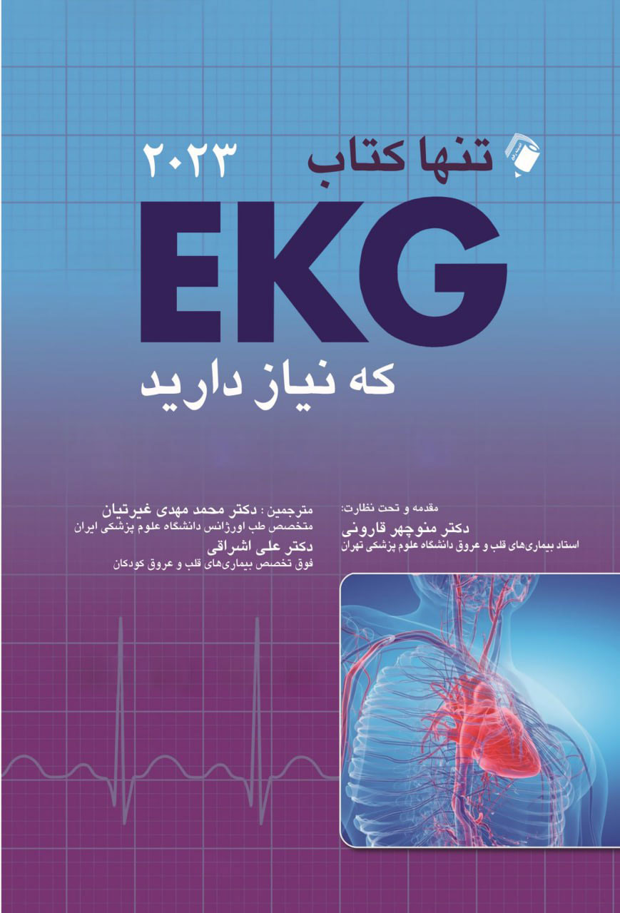 پایانه - تنها EKG که نیاز دارید 2023